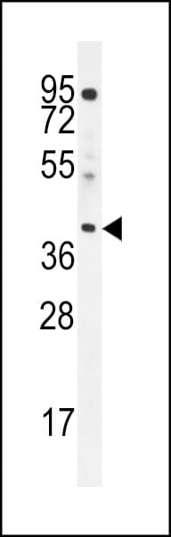 ELMOD2 Antibody (aa251-279)