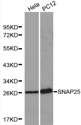 SNAP25 Antibody