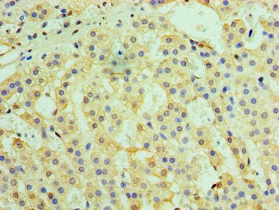 NAK / TBK1 Antibody