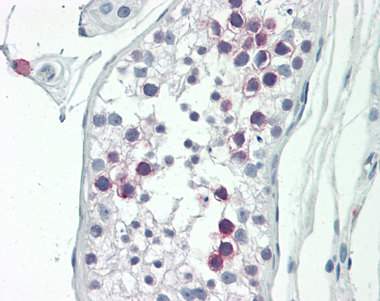 SLC22A16 Antibody (aa101-150)