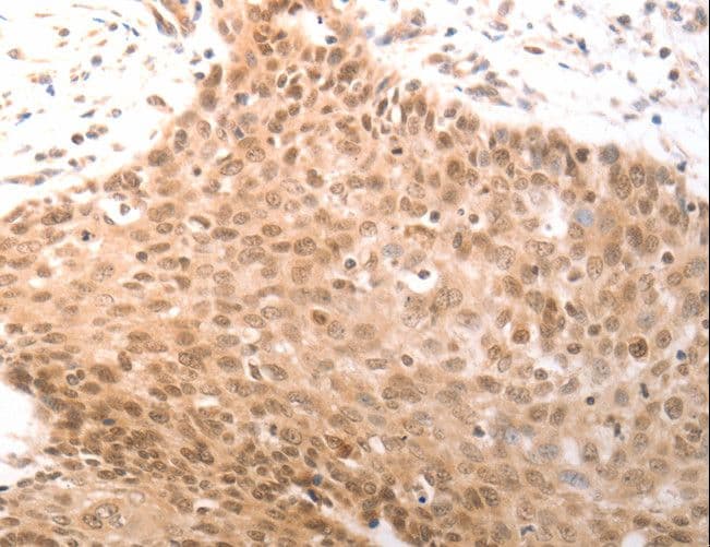 PARP1 Antibody