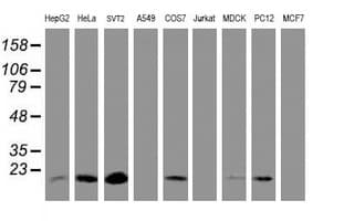 TIMP2 Antibody (clone OTI1D7, Carrier-free)