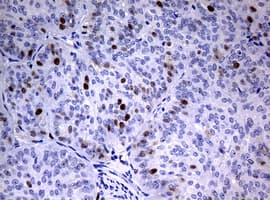 PCNA Antibody (clone OTI8C12)