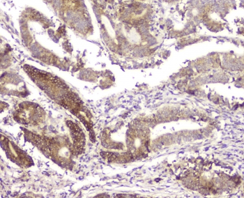 RMI2 / C16orf75 Antibody