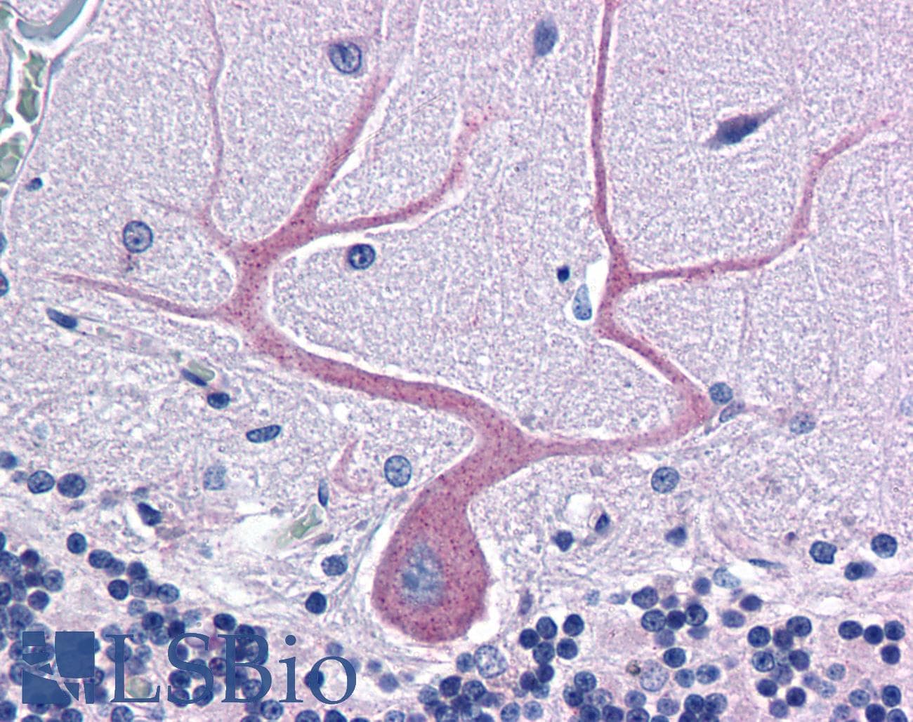 IHC-plus™ CDC42BPA / MRCK Antibody (aa2-14)