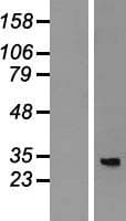 MRPL4 / MRP-L4 Protein (Over-Expression Lysate Myc-DDK (Flag))