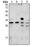 SDC2 / Syndecan 2 Antibody