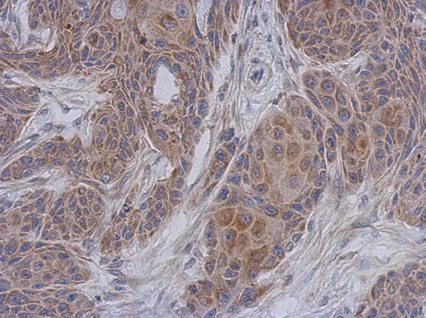 NDUFA12 / B17.2 Antibody (aa1-145)