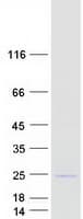Human SPCS3 Protein (Recombinant Myc-DDK (Flag))