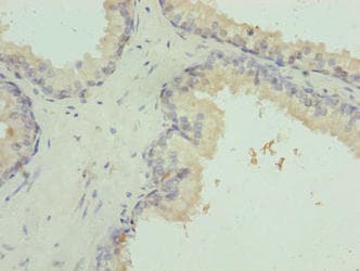 VWA9 / C15orf44 Antibody