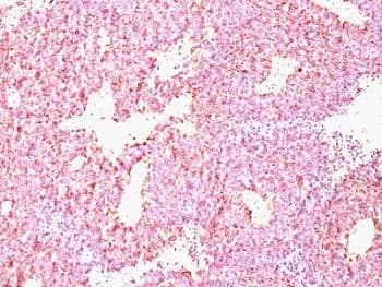 CHGA / Chromogranin A Antibody (clone CHGA/798)
