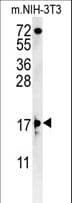 Polyclonal Rabbit anti-Human ENY2 Antibody (aa2-31, WB)