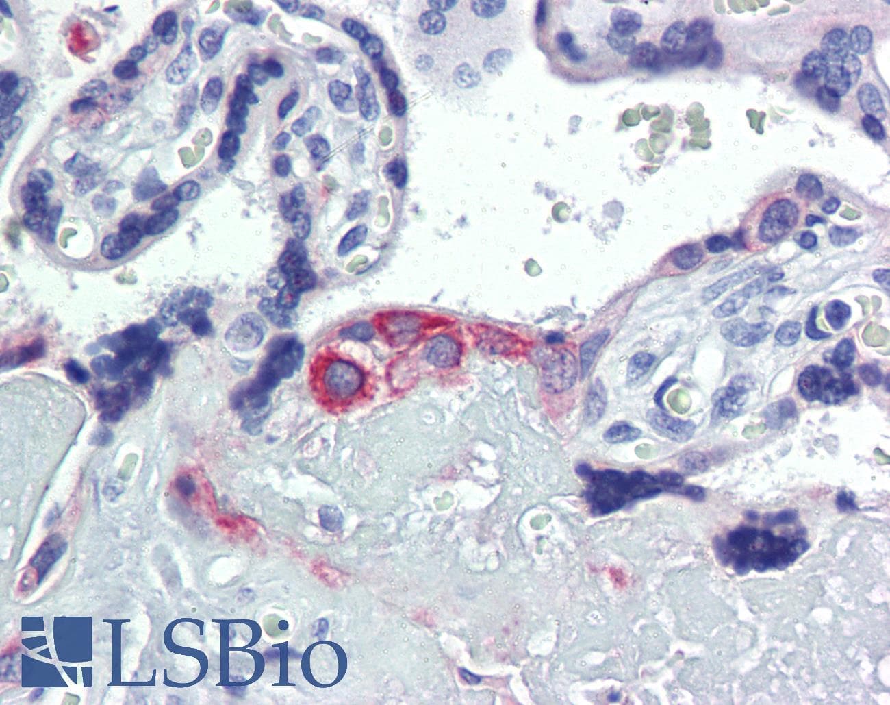 IHC-plus™ KRT7 / CK7 / Cytokeratin 7 Antibody (clone 5D12)