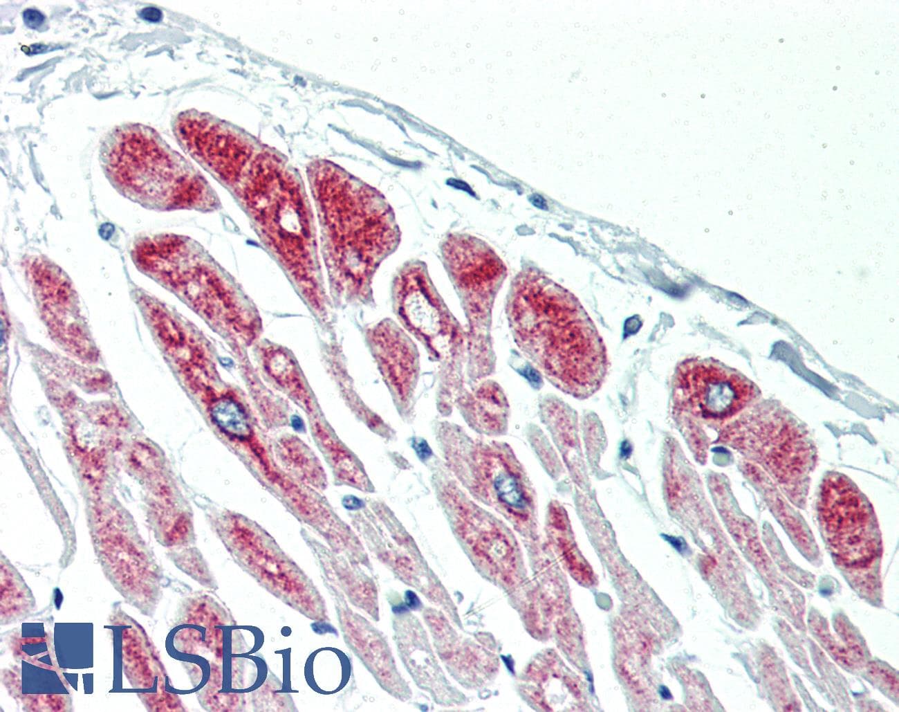 IHC-plus™ DES / Desmin Antibody