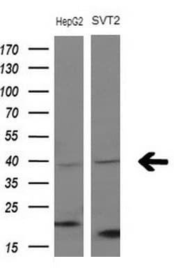 Monoclonal Mouse anti-Human FBLIM1 / Migfilin Antibody (clone OTI3G1, Carrier-free, aa1-242, WB)