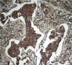 AKT1 Antibody