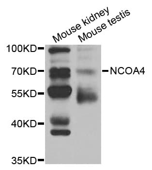 ARA70 / NCOA4 Antibody