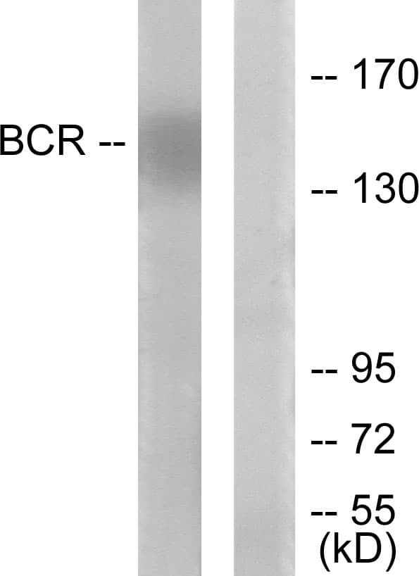 CML / BCR Antibody (aa144-193)