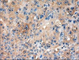 PTCH1 / Patched 1 Antibody (clone OTI5C7)