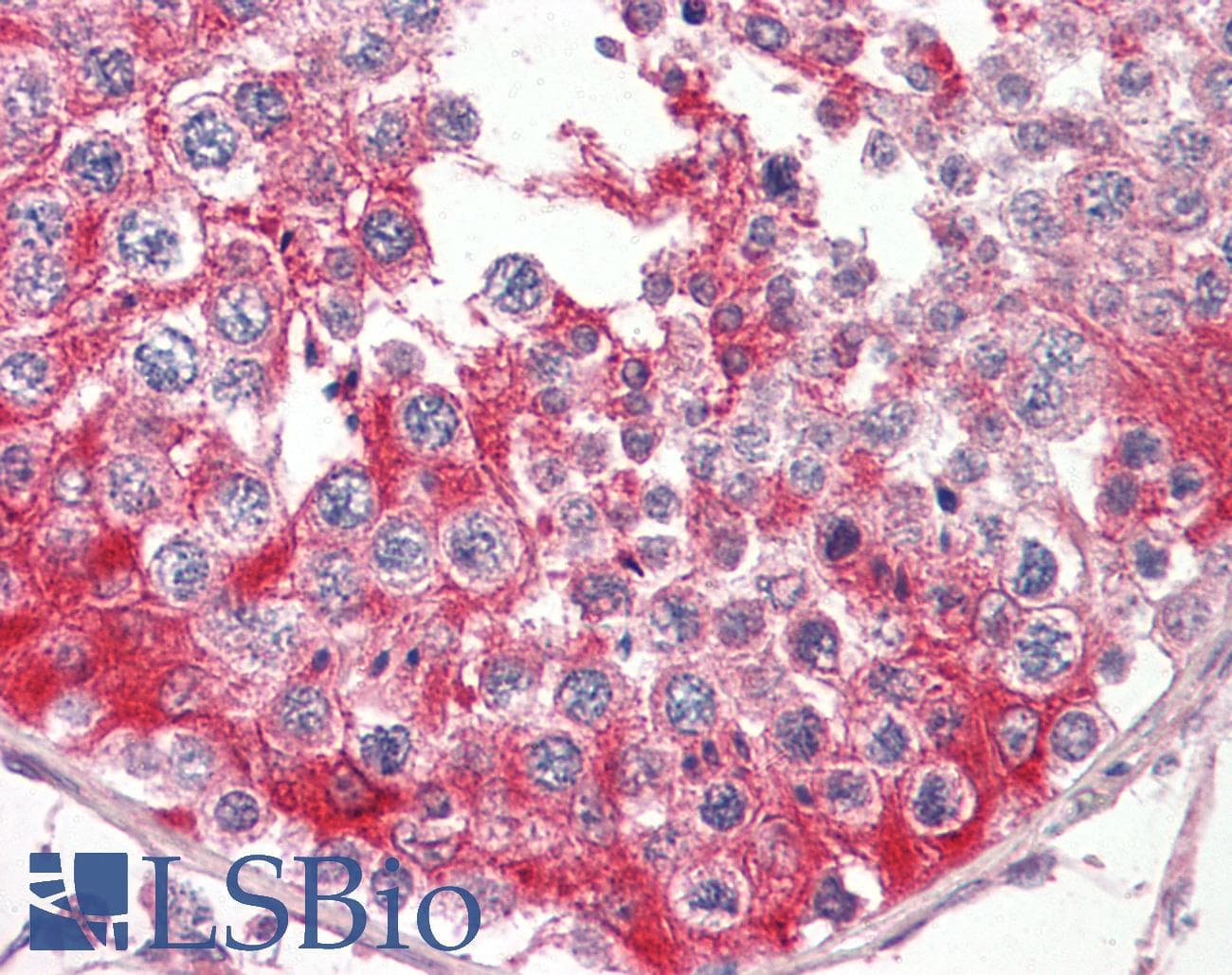 PathPlus™ Polyclonal Goat anti-Human EFNB2 / Ephrin B2 Antibody (aa62-74, IHC, WB)