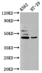 Polyclonal Rabbit anti-Human B3GNT6 Antibody (IHC, WB)