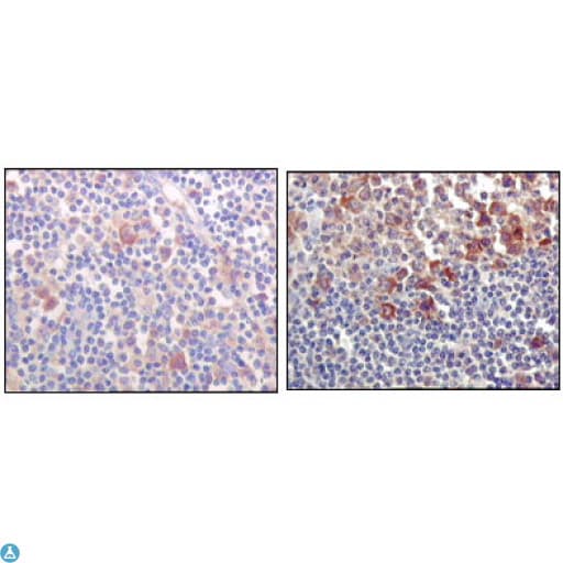 BTK Antibody