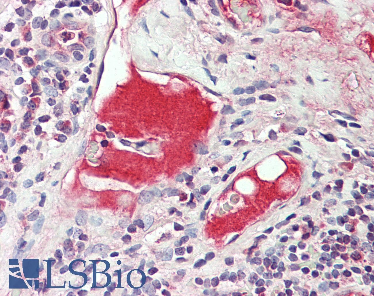 KNG1 / Kininogen / Bradykinin Antibody (FITC)