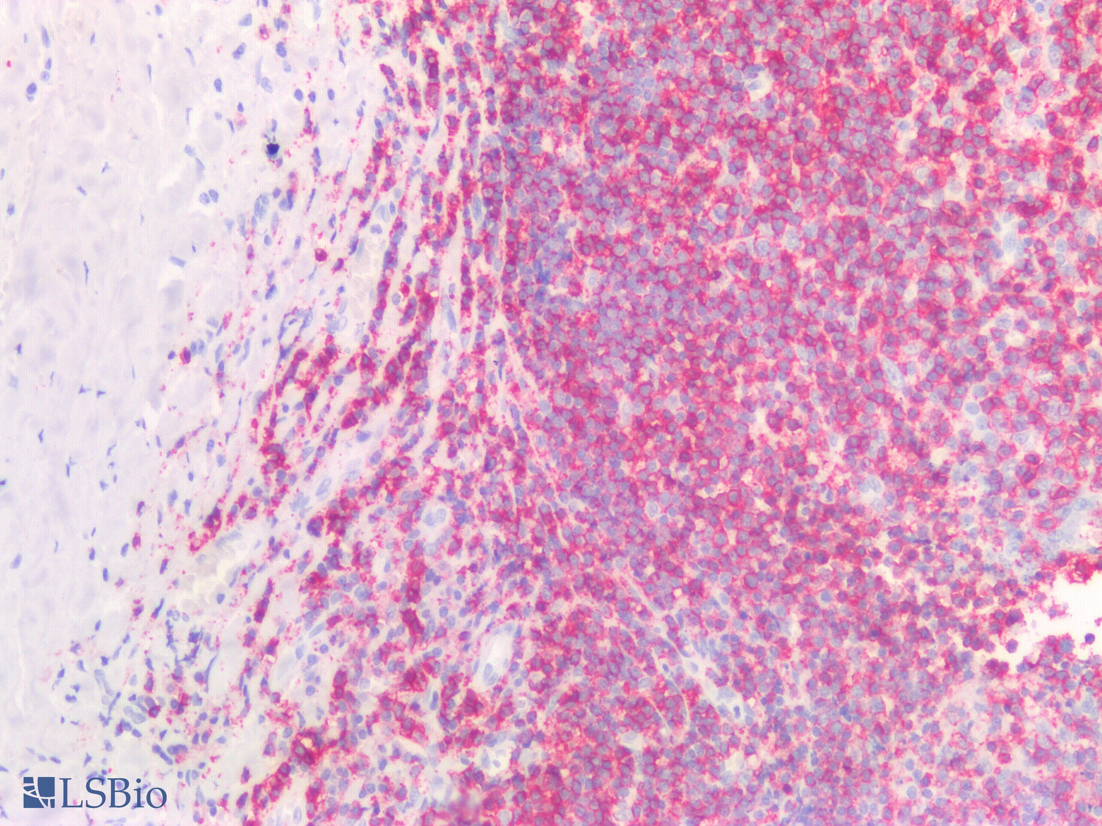 IHC-plus™ CD45R Antibody (Concentrated)