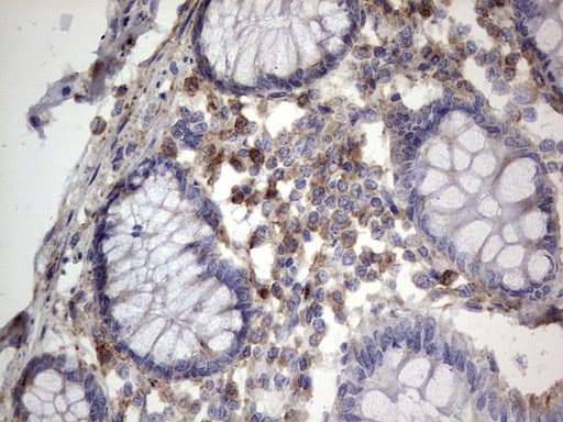 Monoclonal Mouse anti-Human MTDH / Metadherin Antibody (clone OTI2H4, aa70-582, IHC, WB)