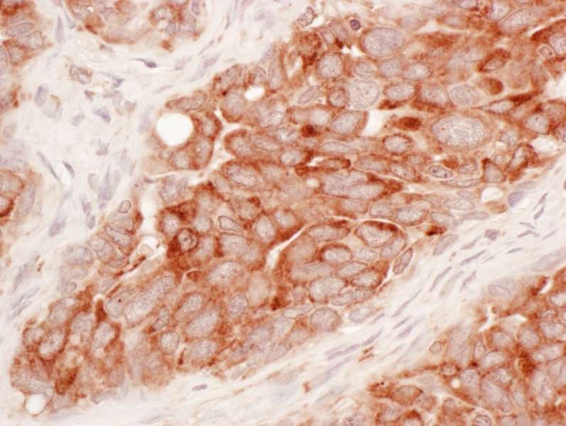 IHC-plus™ Polyclonal Rabbit anti-Human RTN3 / Reticulon 3 Antibody (aa750-800, IHC, WB)