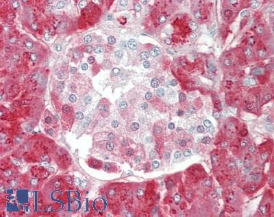 IHC-plus™ Polyclonal Rabbit anti-Human SPINK1 Antibody (Internal, IHC, IF)