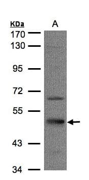 Polyclonal Rabbit anti-Human SEPT7 / Septin 7 Antibody (aa192-437, IHC, WB)
