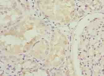 IHC-plus™ Polyclonal Rabbit anti-Human LRRN3 Antibody (IHC, WB)