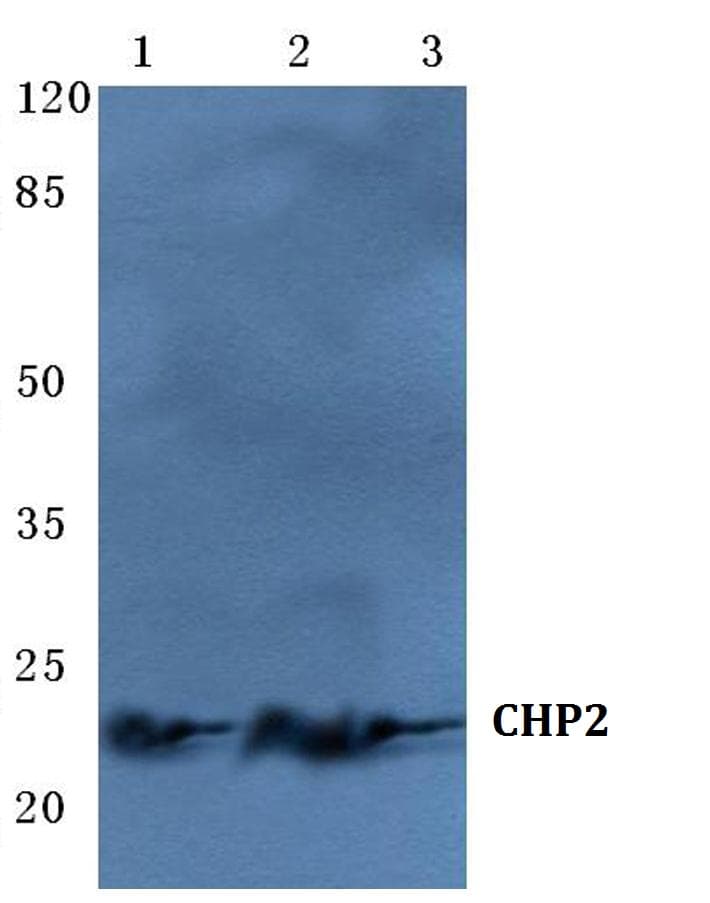 IHC-plus™ CHP2 Antibody (aa146-191)
