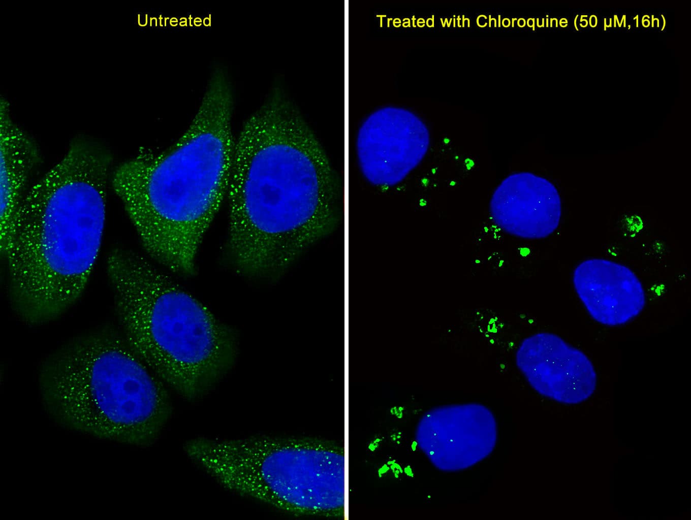 APG5 / ATG5 Antibody (aa209-238)