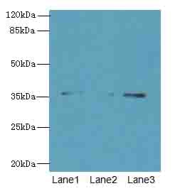 Polyclonal Rabbit anti-Human FOXR2 Antibody (IHC, WB)