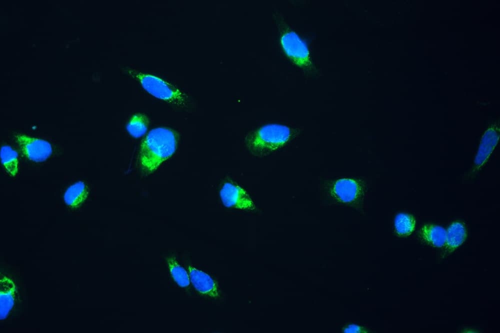 Polyclonal Rabbit anti-Human FH / Fumarase / MCL Antibody (IHC, WB)