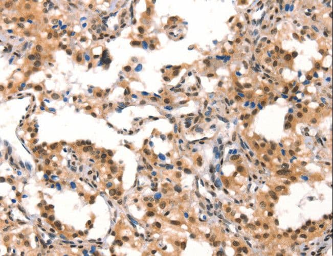 Cullin 4B / CUL4B Antibody
