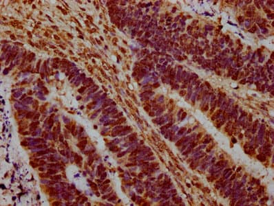 HIST1H1C Antibody