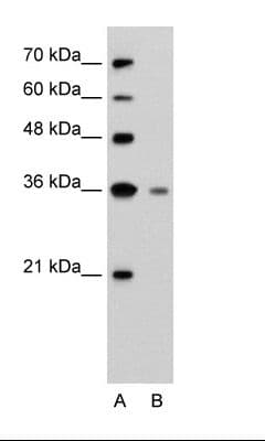 GZMH / Granzyme H Antibody (N-Terminus, FITC)