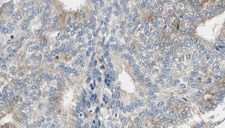 ADH5 Antibody