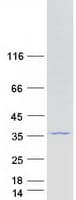 Human GNPDA2 Protein (Recombinant Myc-DDK (Flag))
