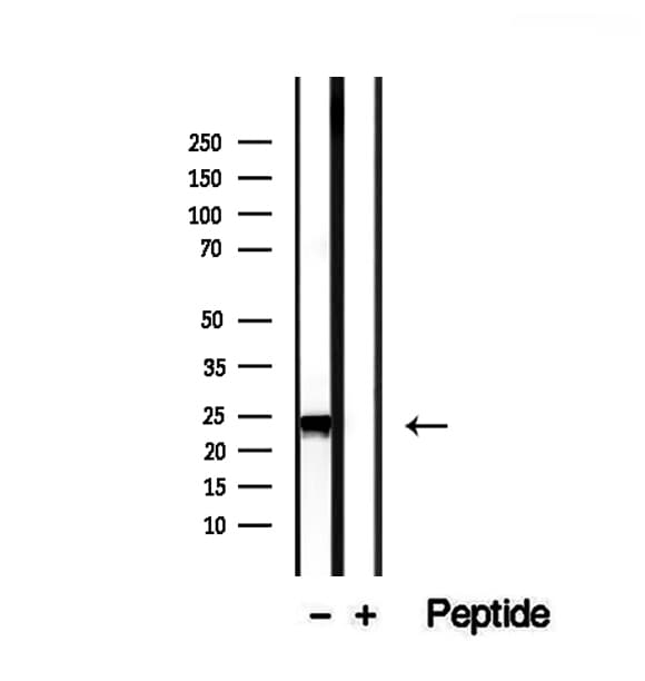 RAB14 Antibody