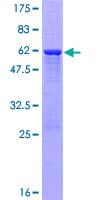 Human PPM1M Protein (Recombinant GST)