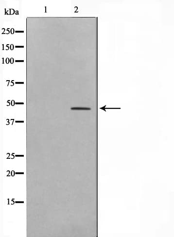 Polyclonal Rabbit anti-Human C/EBP Beta / CEBPB Antibody (IF, WB)