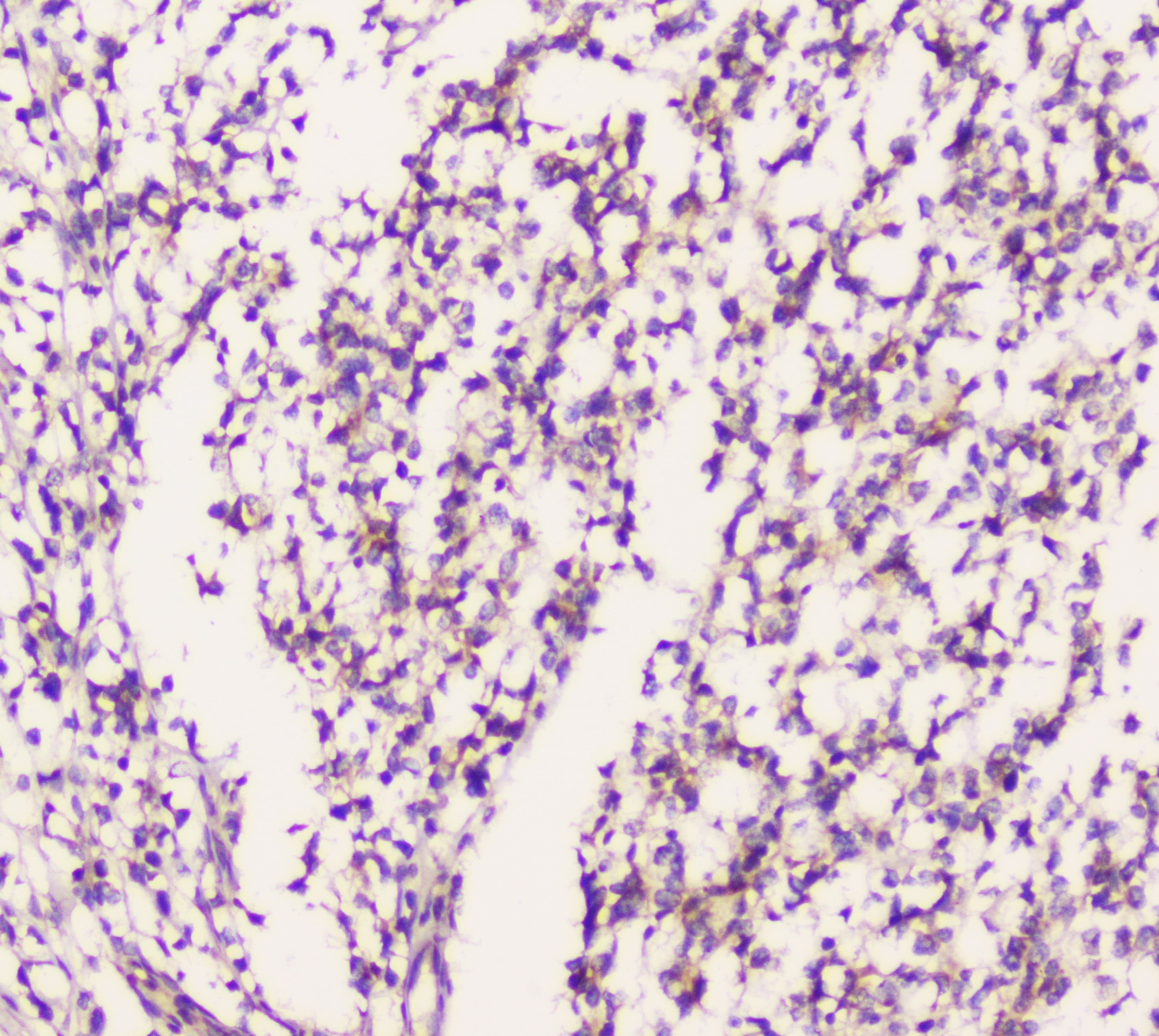 Polyclonal Rabbit anti-Human EML4 Antibody (IHC, WB)