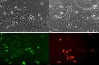 Polyclonal Rabbit anti-Human NEUROD1 Antibody (aa15-45, IHC, IF, WB)