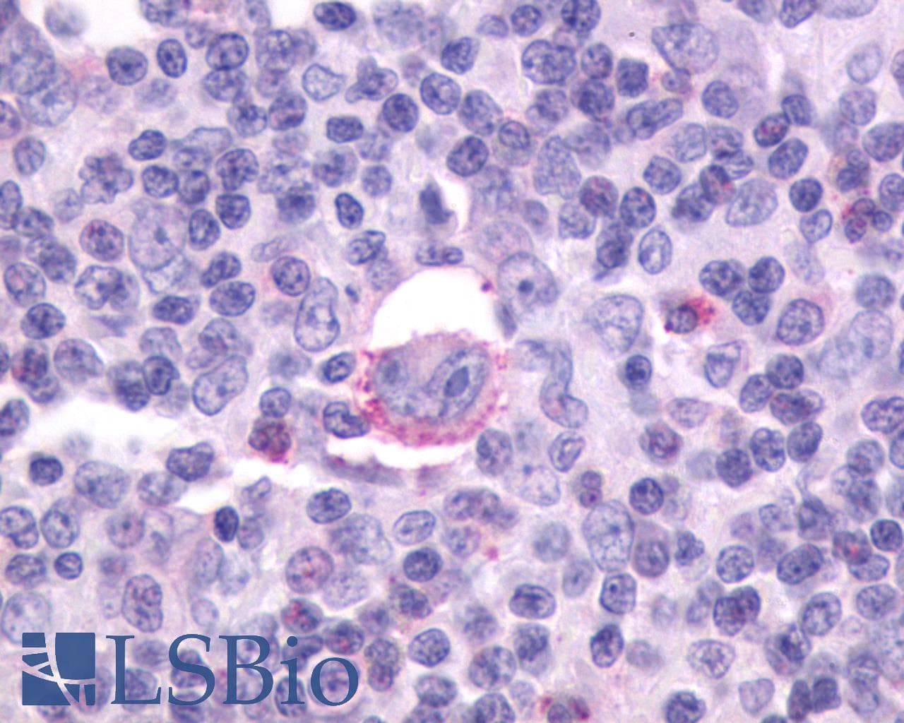 IHC-plus™ Polyclonal Rabbit anti-Human CXCR5 Antibody (C-Terminus, IHC)