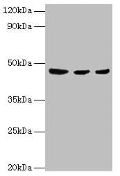 ENTPD5 / CD39L4 Antibody (aa149-428)