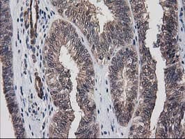 DSTN / Destrin Antibody (clone OTI1D5)